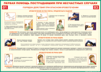 Таблица Порядок действий при опасном кровотечении 1000*1400 винил - «globural.ru» - Первоуральск